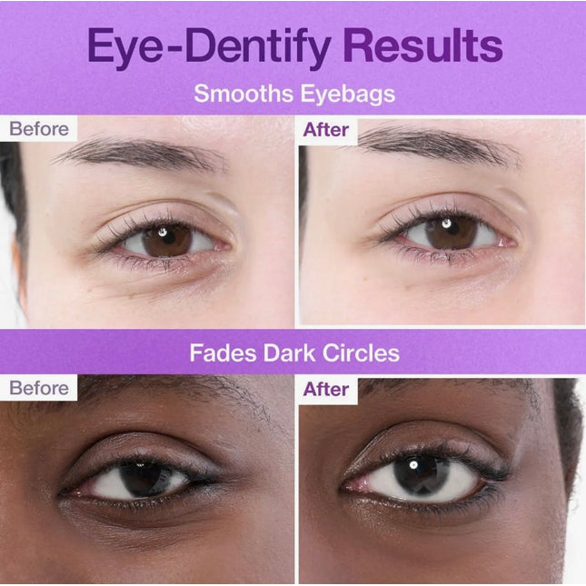 numbuzin No.9 NAD+ Collagen Under Eye Patches | 5 Pairs