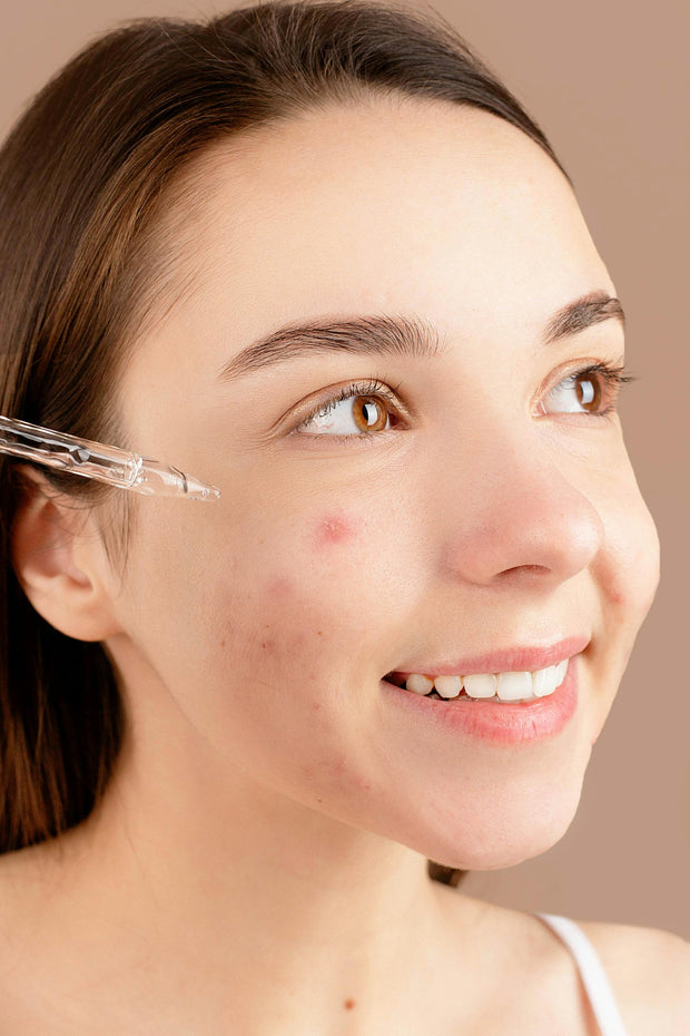 <h4>Blemishes</h4>